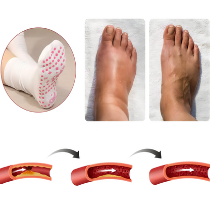 Terapeutske čarape – poboljšavaju cirkulaciju i zagrevaju stopala